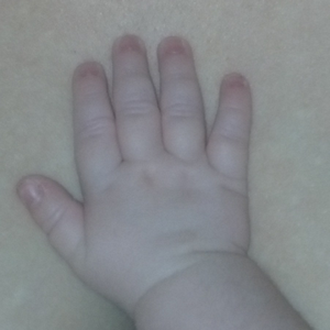 an infant's hand rests on exposed skin